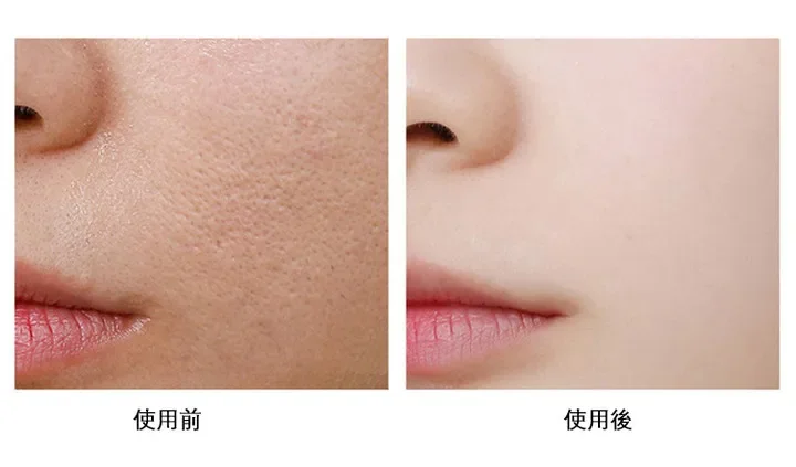 1692273669722624.png 1df73cf05c41df0acf10ded187133db.png