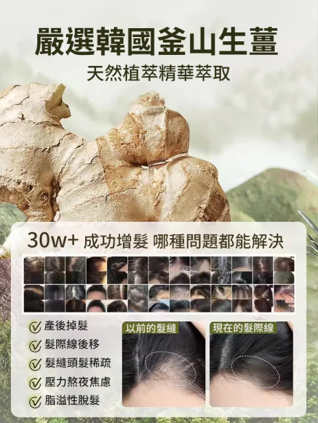 爆款生薑植萃防脫育髮洗頭膏 火爆熱銷中！台灣本土出貨！24小時在線客服，售後無憂！現在下單享受在線支付立減活動！